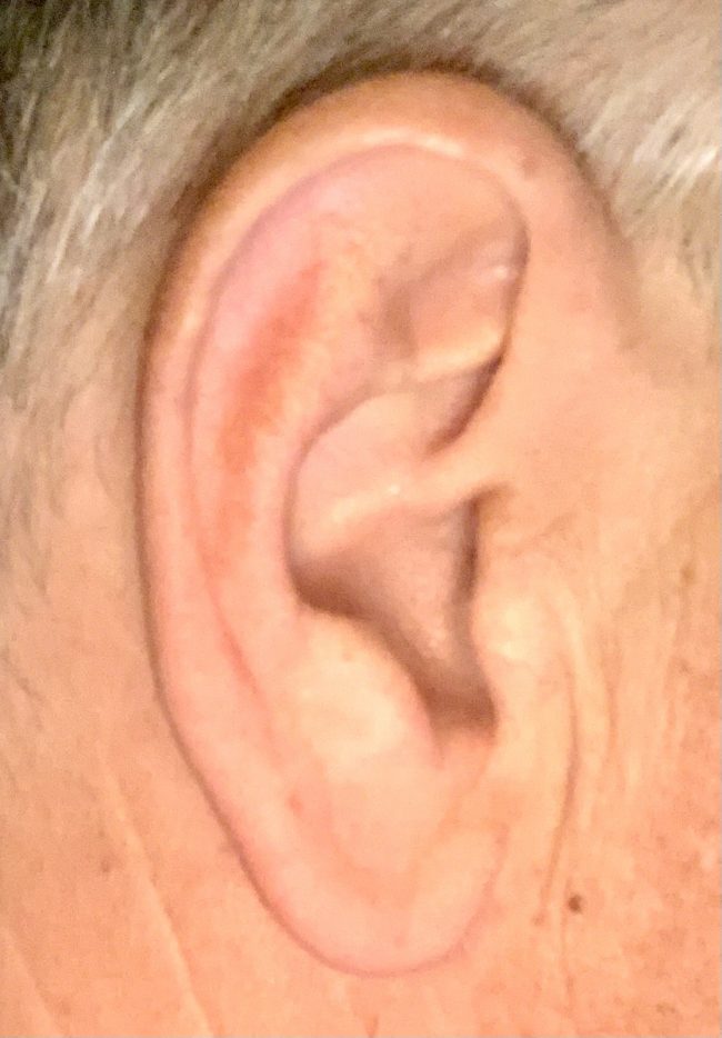 Ear