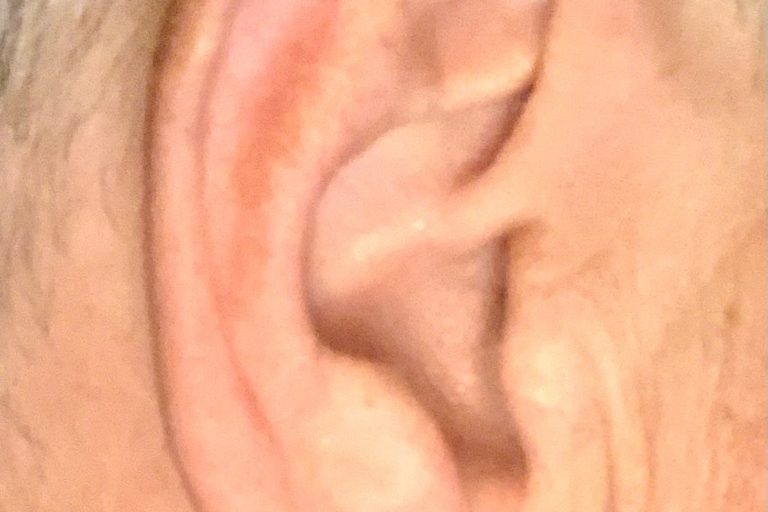 Ear